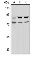 Prolyl Endopeptidase