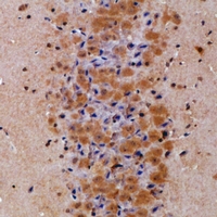 Rabbit Polyclonal Antibody to Prolyl Endopeptidase