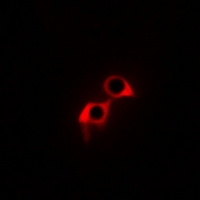 Rabbit Polyclonal Antibody to GPR169