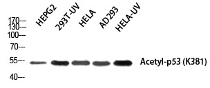 p53 (Acetyl-Lys381)