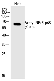NFκB-p65 (Acetyl-Lys310)