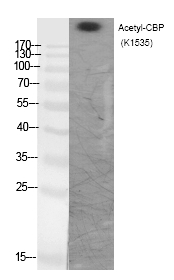 CBP (Acetyl-Lys1535)