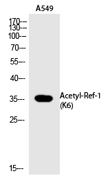 Ref-1 (Acetyl-Lys6)