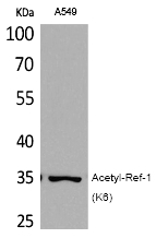 Rabbit Polyclonal Antibody to Ref-1 (Acetyl-Lys6)
