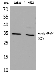 Rabbit Polyclonal Antibody to Ref-1 (Acetyl-Lys7)