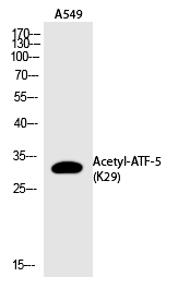 ATF-5 (Acetyl-Lys29)