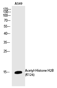 Histone H2B (Acetyl-Lys126)