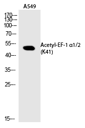 EF-1 α1/2 (Acetyl-Lys41)