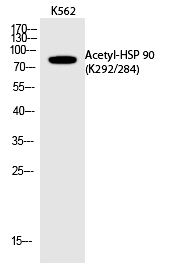 HSP 9(Acetyl-Lys292/284)