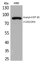 Rabbit Polyclonal Antibody to HSP 9(Acetyl-Lys292/284)