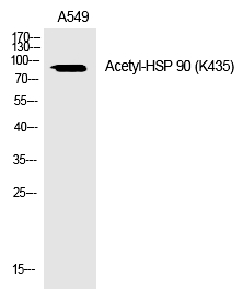 HSP 9(Acetyl-Lys435)