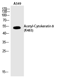Cytokeratin 8 (Acetyl-Lys483)