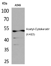 Rabbit Polyclonal Antibody to Cytokeratin 8 (Acetyl-Lys483)