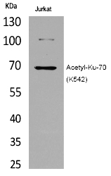 Ku-7(Acetyl-Lys542)