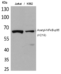 Rabbit Polyclonal Antibody to NFκB-p65 (Acetyl-Lys218)