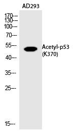 p53 (Acetyl-Lys370)