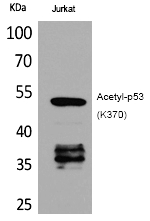 Rabbit Polyclonal Antibody to p53 (Acetyl-Lys370)