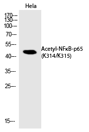 NFκB-p65 (Acetyl-Lys314/Lys315)