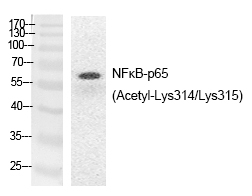 Rabbit Polyclonal Antibody to NFκB-p65 (Acetyl-Lys314/Lys315)