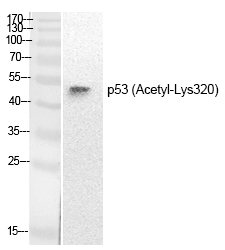 Rabbit Polyclonal Antibody to p53 (Acetyl-Lys320)