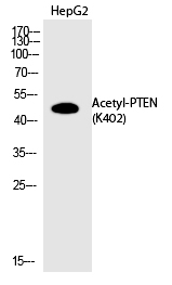 PTEN (Acetyl-Lys402)