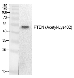 Rabbit Polyclonal Antibody to PTEN (Acetyl-Lys402)
