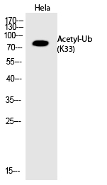Ub (Acetyl-Lys33)