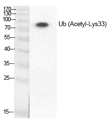 Rabbit Polyclonal Antibody to Ub (Acetyl-Lys33)