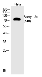 Ub (Acetyl-Lys48)