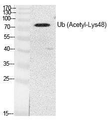 Rabbit Polyclonal Antibody to Ub (Acetyl-Lys48)