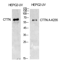 Rabbit Polyclonal Antibody to Cortactin (Acetyl-Lys235)