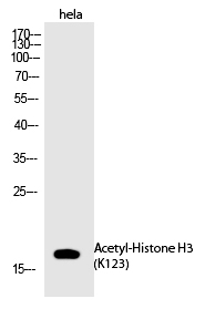 Histone H3 (Acetyl-Lys123)