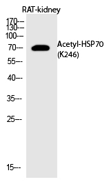 HSP7(Acetyl-Lys246)