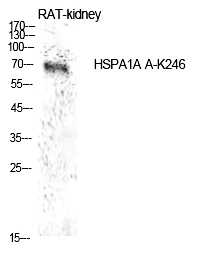 Rabbit Polyclonal Antibody to HSP7(Acetyl-Lys246)