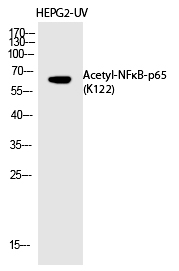 NFκB-p65 (Acetyl-Lys122)