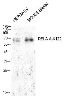 Rabbit Polyclonal Antibody to NFκB-p65 (Acetyl-Lys122)