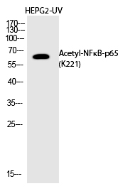 NFκB-p65 (Acetyl-Lys221)