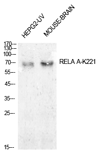 Rabbit Polyclonal Antibody to NFκB-p65 (Acetyl-Lys221)