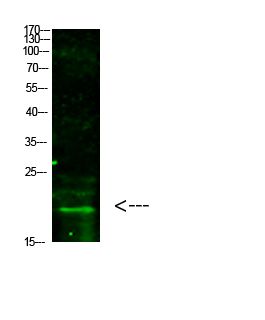 Histone H3 (Tri-Methyl-K5)