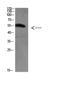 FoxO4 (Acetyl Lys189)