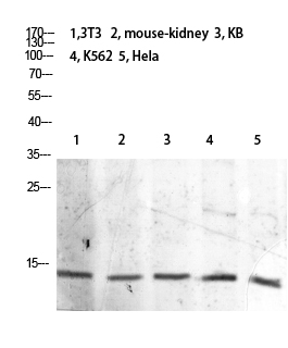 Histone H2B (Acetyl Lys21)