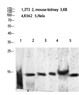 Histone H2B (Acetyl-Lys24/25)