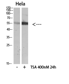 HNF-4α (Acetyl Lys106)