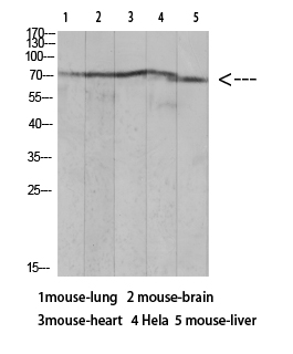 Ku-7(Acetyl Lys317)