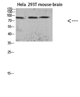 Tau (Acetyl Lys174)