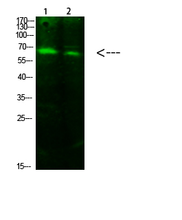 ACSS1 (Acetyl-K642)