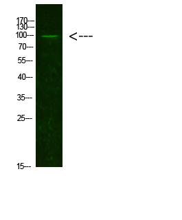 AR(Acetyl-K631)