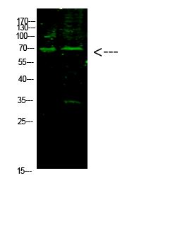 E2F-1 (Acetyl-K117)
