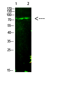 E2F-1 (Acetyl-K125)