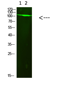 PARP-1 (Acetyl-K521)